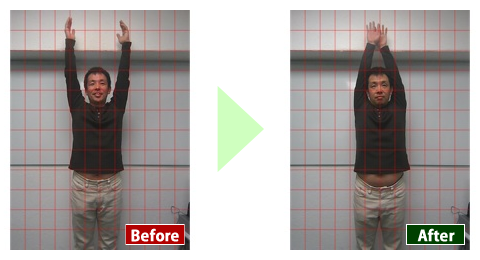 美健セラピー Before After