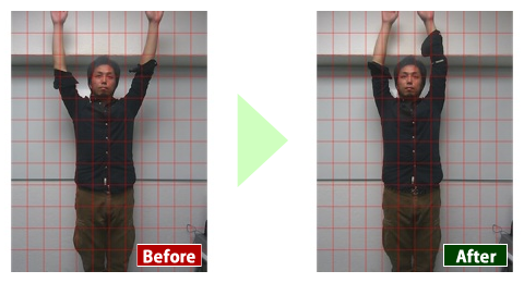 美健セラピー Before After